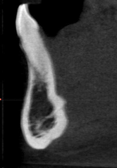 Connected impressions